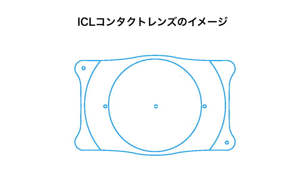 ICLコンタクトレンズのイメージ図